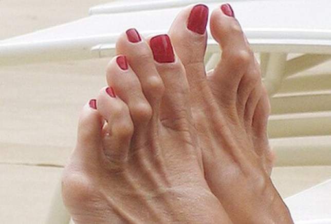 hammertoe tunisia price cheap cost