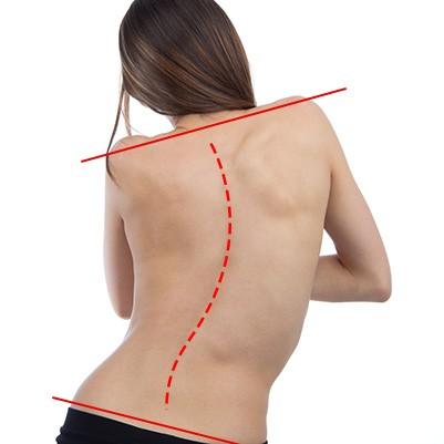 scoliosis tunisia price affordable cost